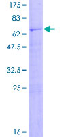 12.5% SDS-PAGE Stained with Coomassie Blue.